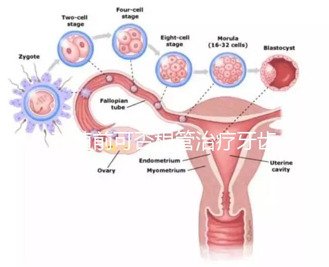 移植前可否根管治療牙齒看情況，這些影響別還不知道