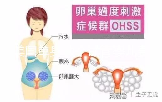 美國單身做個試管嬰兒費用大概要多少？