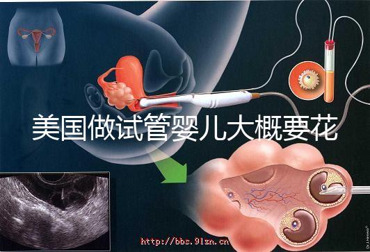 美國做試管嬰兒大概要花多少錢？具體支出25w！