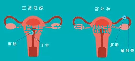 單身去三美泰醫(yī)院做試管需要花費(fèi)多少錢?費(fèi)用明細(xì)是怎么樣的