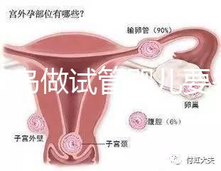 去青島做試管嬰兒要多少錢？