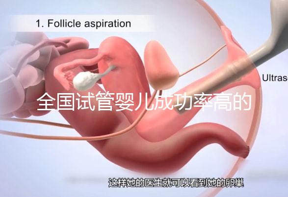全國(guó)試管嬰兒成功率高的醫(yī)院有哪些？（全國(guó)試管嬰兒成功率高的醫(yī)院目錄一覽）