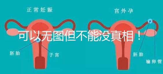 可以無圖但不能沒真相！段濤大夫帶你了解B超檢查報告單