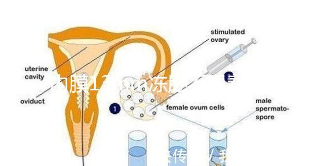內(nèi)膜13mm凍胚不易著床要注意，移植與否看醫(yī)生怎么說(shuō)