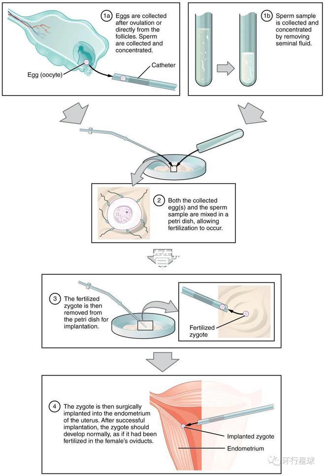 國內首起試管嬰兒案例，法律竟難以給患者維權