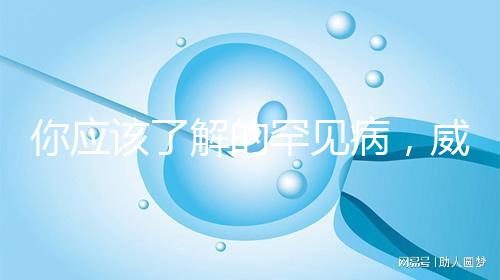 你應該了解的罕見病，威廉姆斯綜合癥