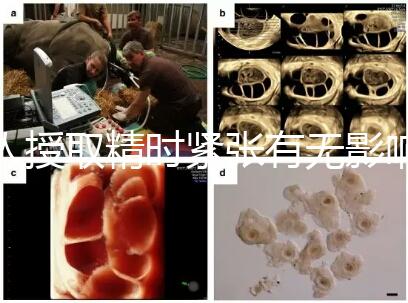 人授取精時(shí)緊張有無(wú)影響別還不造，注意事項(xiàng)不少不可不知