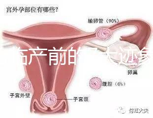 二胎臨產(chǎn)前的7大跡象，出現(xiàn)見(jiàn)紅、陣痛別大意