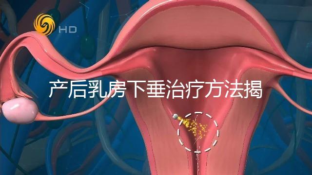 產后乳房下垂治療方法揭秘，按摩手法再好也沒提前預防有用