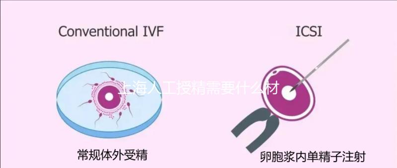 上海人工授精需要什么材料和手續戳，提前做好準備很重要