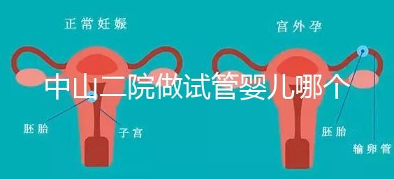 中山二院做試管嬰兒哪個醫生好？附醫院試管成功率