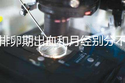排卵期出血和月經(jīng)別分不清，4大區(qū)別輕松判斷