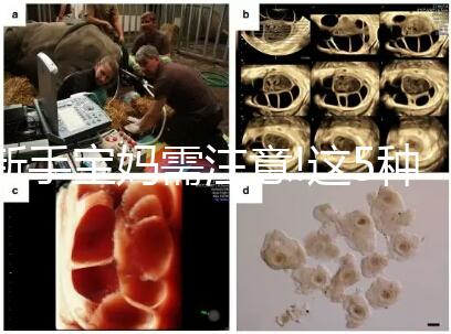 新手寶媽需注意!這5種原因是導(dǎo)致嬰兒腹瀉的罪魁禍首