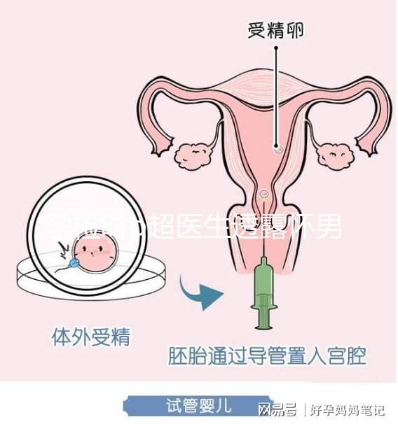 孕檢時b超醫生透露懷男寶女寶暗語寶典，一語戳中有心人！