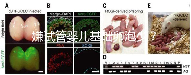 嫌試管嬰兒基礎卵泡少？并非只能食療，這份增多錦囊請收下