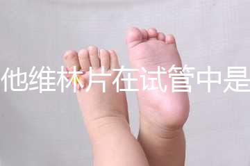 屈他維林片在試管中是否有副作用,導(dǎo)致胎停不是空穴來風