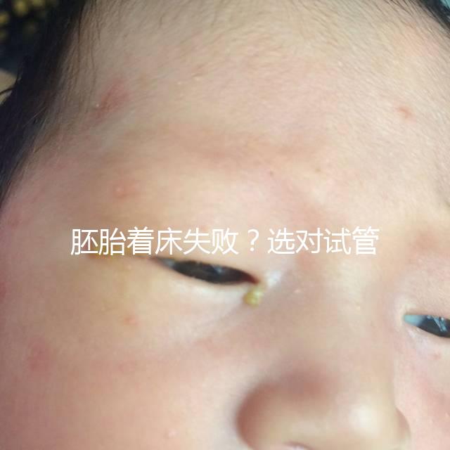 胚胎著床失??？選對試管嬰兒醫(yī)生很重要