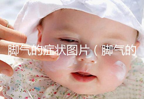 腳氣的癥狀圖片(腳氣的癥狀圖片,腳氣圖片大全)