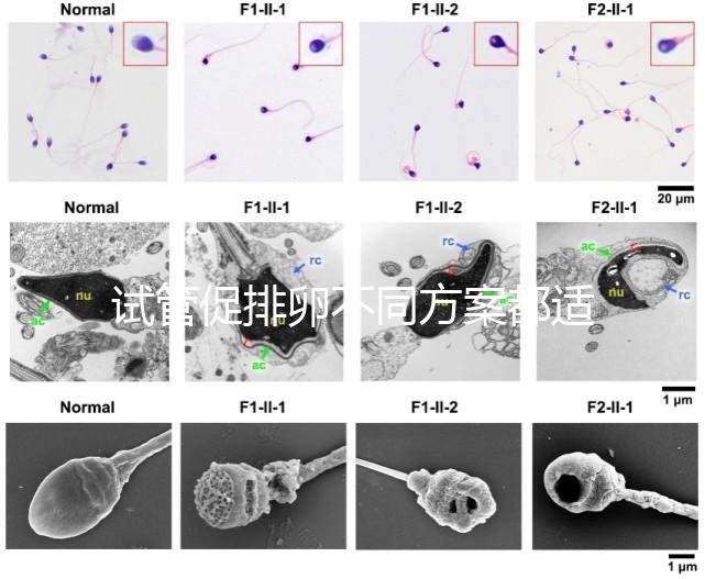 試管促排卵不同方案都適合哪些人？如何監(jiān)測排卵？