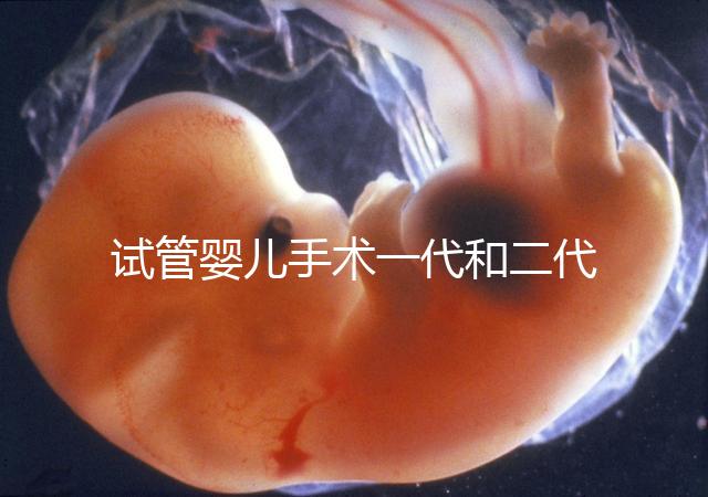 試管嬰兒手術(shù)一代和二代有哪些區(qū)別？