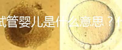 試管嬰兒是什么意思？什么是試管嬰兒？