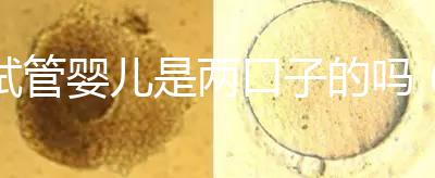 試管嬰兒是兩口子的嗎（試管嬰兒是兩夫妻的孩子嗎）