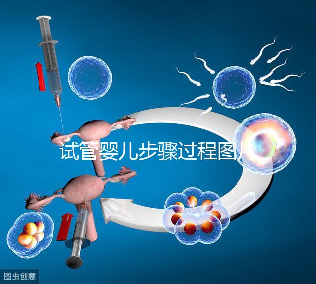 試管嬰兒步驟過程圖片