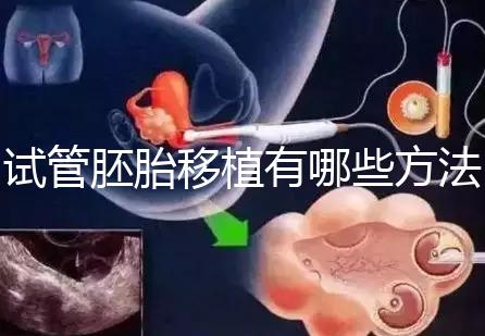 試管胚胎移植有哪些方法？