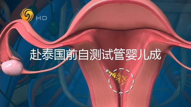 赴泰國前自測試管嬰兒成功率，這些方法值得收藏