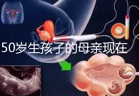 50歲生孩子的母親現在過得真不怎么樣，大齡不建議沖三胎