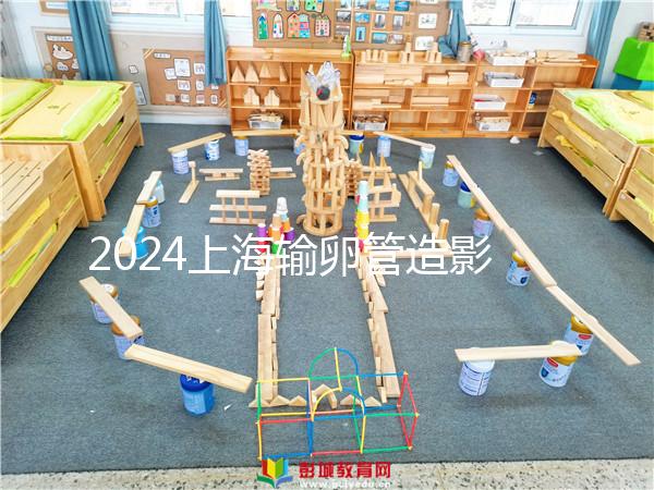 2024上海輸卵管造影檢查多少錢速覽，關(guān)鍵看能否報銷