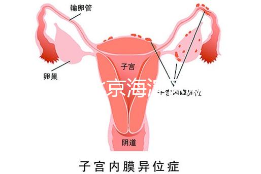 2024年北京海淀區新生兒醫療保險處理策略，照片要求不要出錯